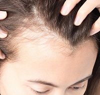 Стволовые клетки как средство от облысения: результаты последний исследований
