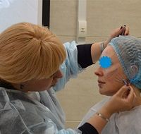 Молодость и гармония - от  «французского консенсуса» до Full-face 