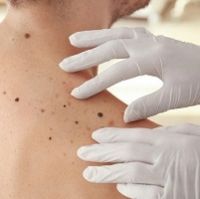 Стандарты медицинской помощи при злокачественных образованиях кожи