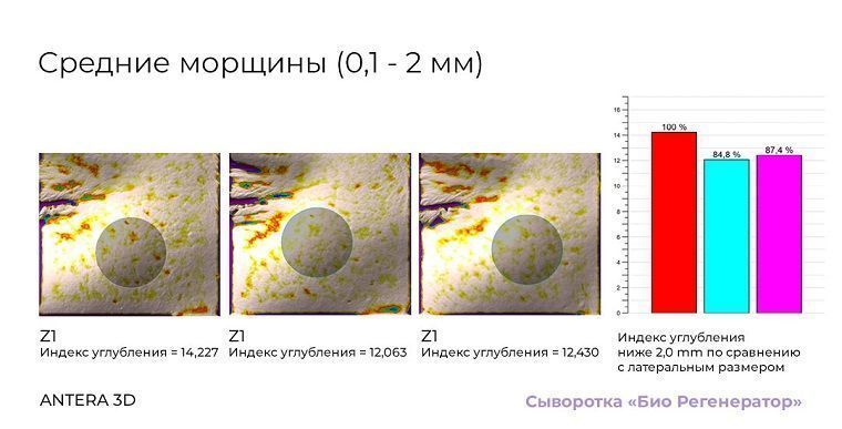 Первое в мире исследование космецевтики методом цитоиммунограммы кожи - 1