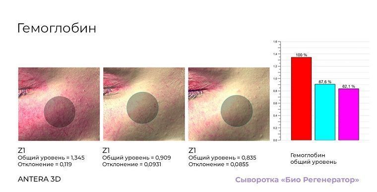 Первое в мире исследование космецевтики методом цитоиммунограммы кожи - 1