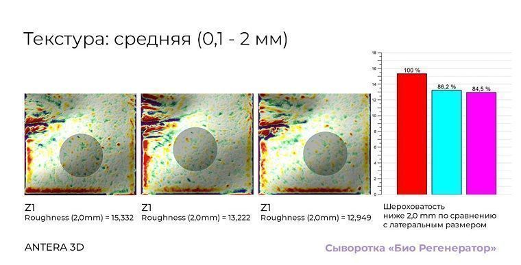 Первое в мире исследование космецевтики методом цитоиммунограммы кожи - 1