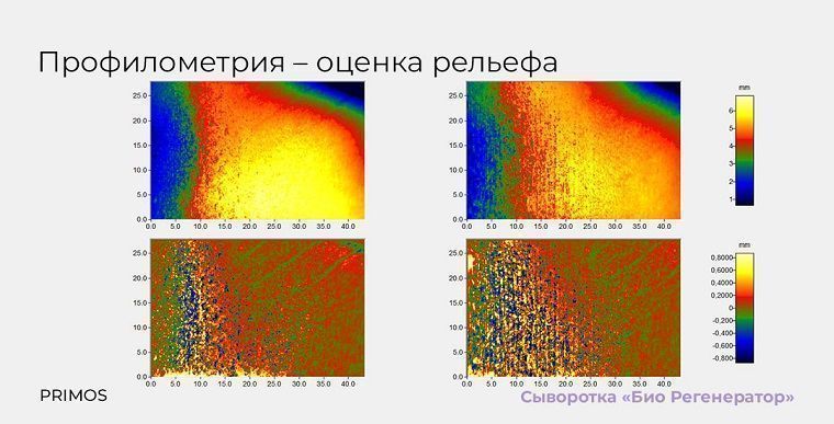 Первое в мире исследование космецевтики методом цитоиммунограммы кожи - 1