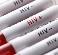 Регистр ВИЧ-инфицированных